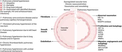 Advances in epigenetic modifications of autophagic process in pulmonary hypertension